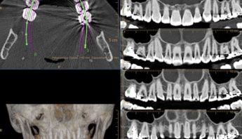dentascanner scanner paris imagerie paris 13 radiologie irm scanner radiographie echographie doppler osteodensitometrie senologie infiltration paris 13